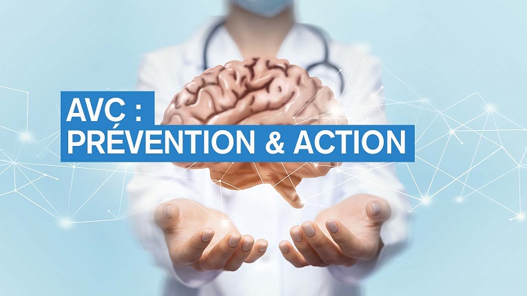 Accident vasculaire cérébral : de la prévention à l'action